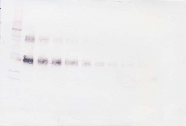 CD25 (soluble) Antibody in Western Blot (WB)