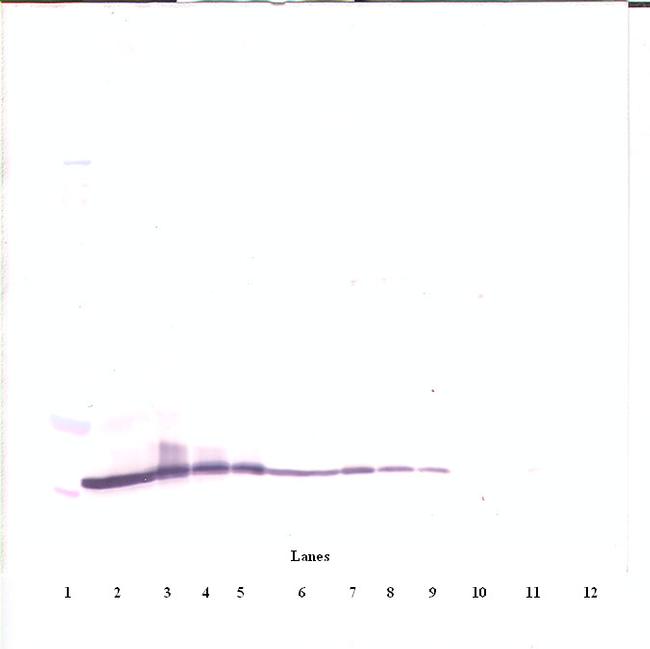 CTGF Antibody in Western Blot (WB)