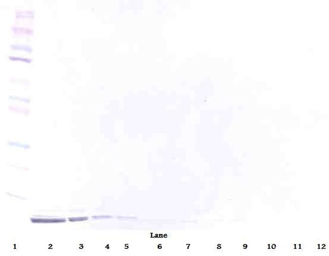 beta-Defensin 1 Antibody in Western Blot (WB)