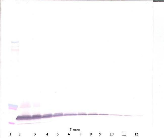 betacellulin Antibody in Western Blot (WB)