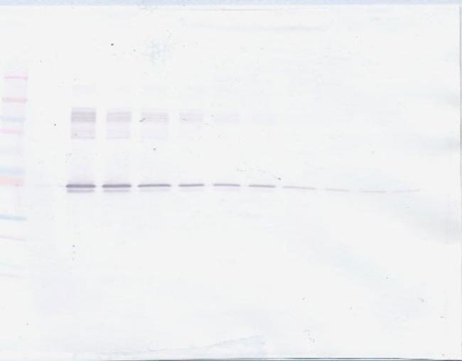 PAI1 Antibody in Western Blot (WB)