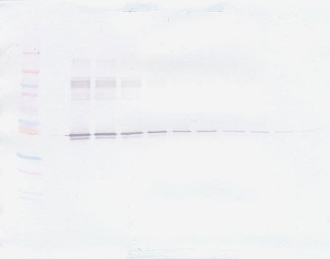 PAI1 Antibody in Western Blot (WB)