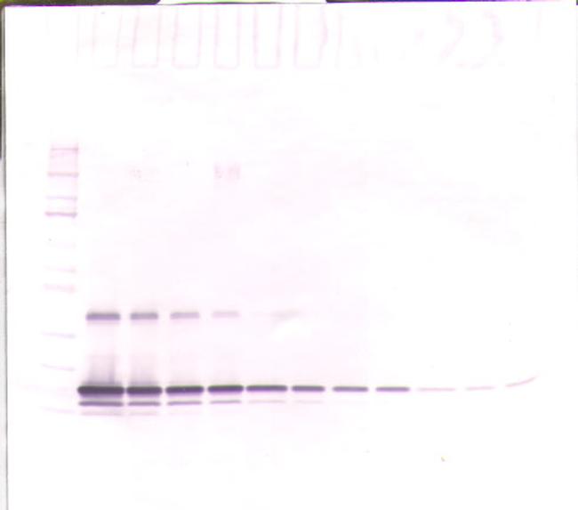 TIMP1 Antibody in Western Blot (WB)