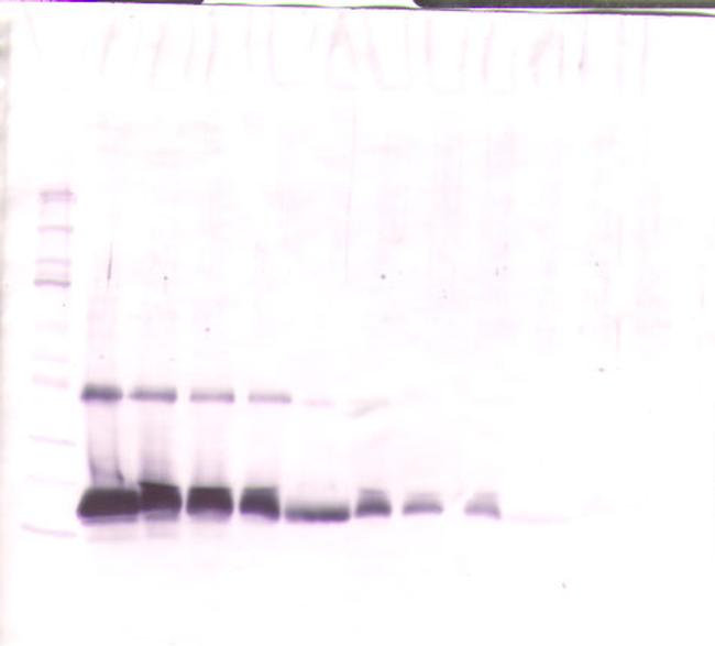 TIMP1 Antibody in Western Blot (WB)