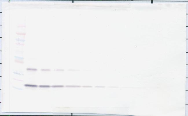 TIMP1 Antibody in Western Blot (WB)