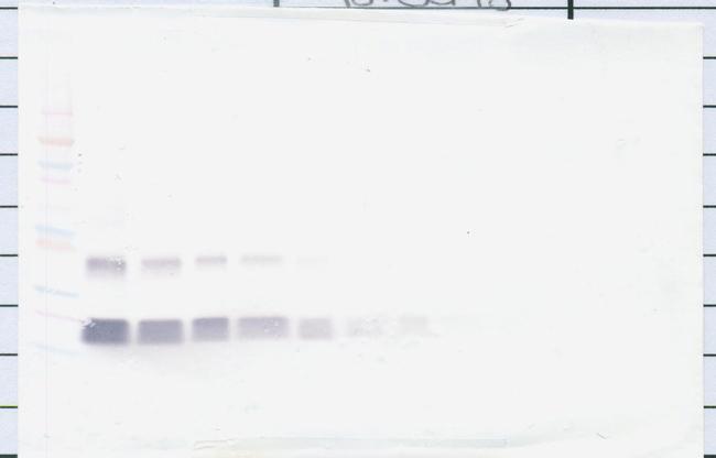 TIMP1 Antibody in Western Blot (WB)