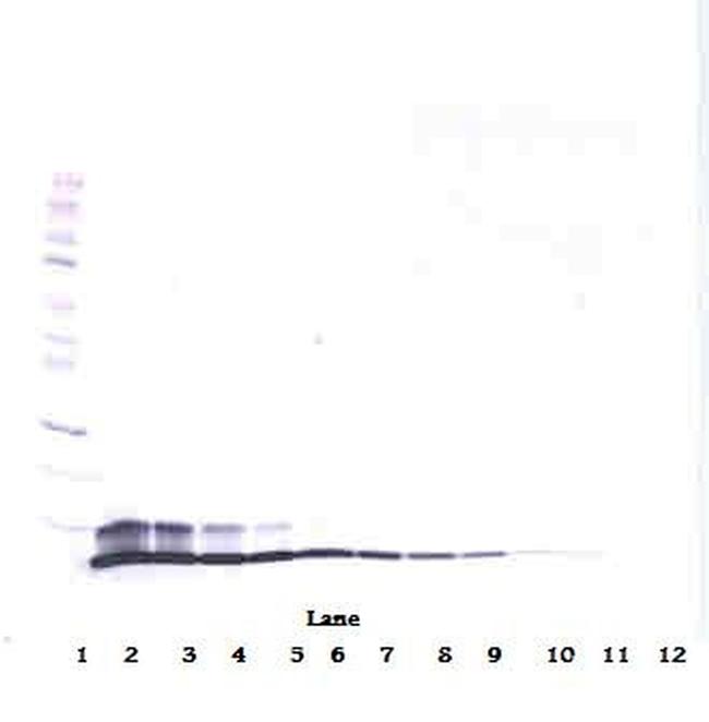 HRG beta-1 Antibody in Western Blot (WB)