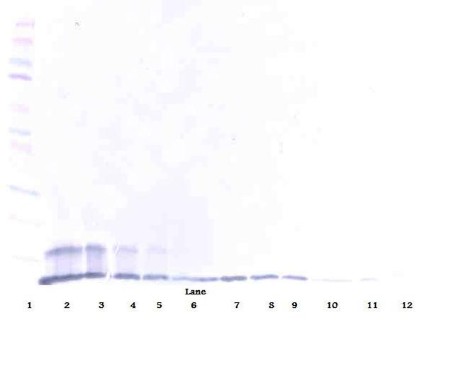 TRAIL-R2 (DR5) (soluble) Antibody in Western Blot (WB)