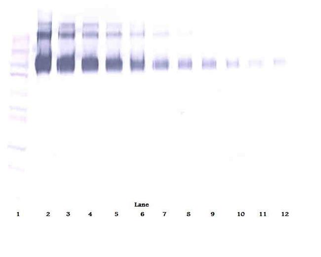 EGFR Antibody in Western Blot (WB)