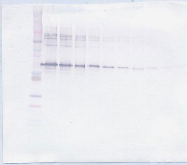 MMP2 Antibody in Western Blot (WB)