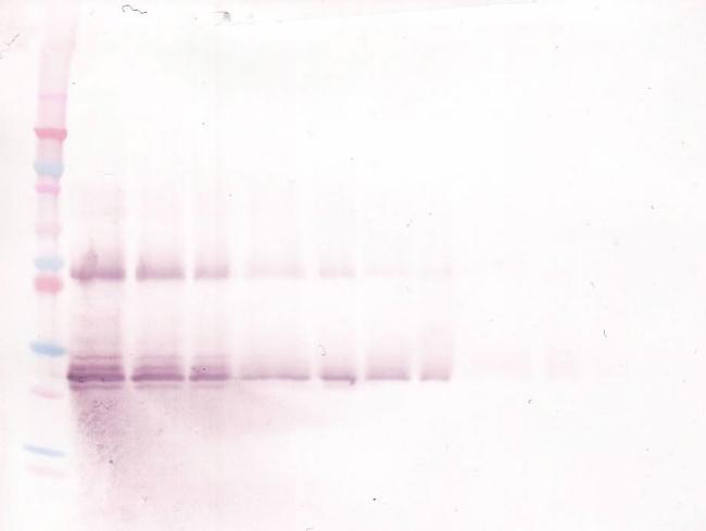 Oncostatin M Antibody in Western Blot (WB)