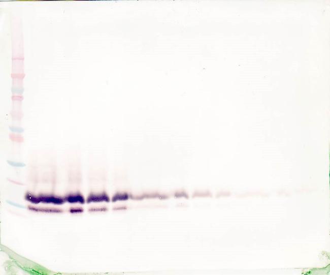 TFF2 Antibody in Western Blot (WB)