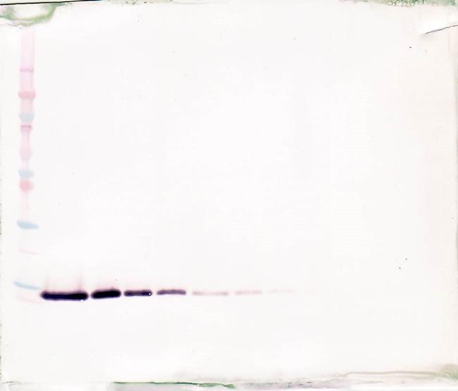 TFF2 Antibody in Western Blot (WB)