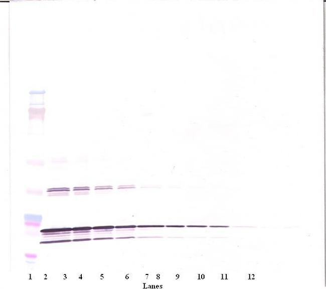 TNF beta Antibody in Western Blot (WB)