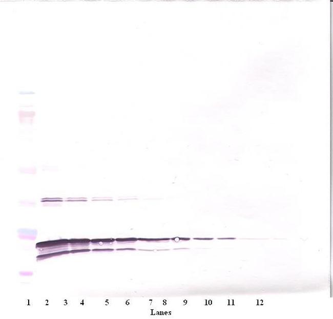 TNF beta Antibody in Western Blot (WB)