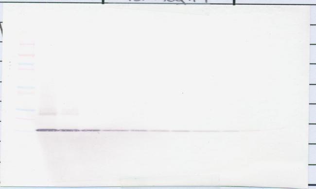 Amphiregulin Antibody in Western Blot (WB)