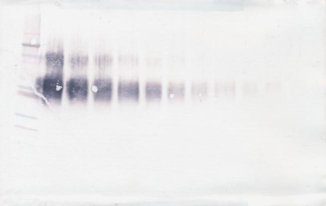 IL4R (soluble) Antibody in Western Blot (WB)