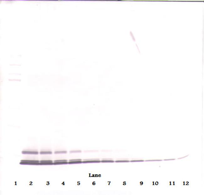 CCL5 (RANTES) Antibody in Western Blot (WB)