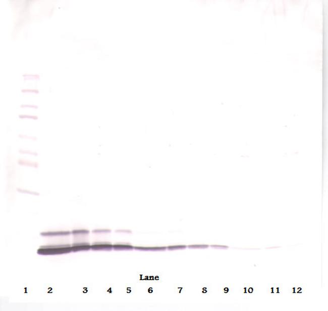 CCL5 (RANTES) Antibody in Western Blot (WB)