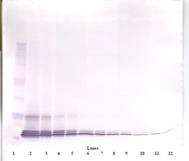 Eotaxin Antibody in Western Blot (WB)