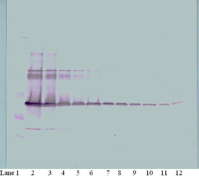 M-CSF Antibody in Western Blot (WB)