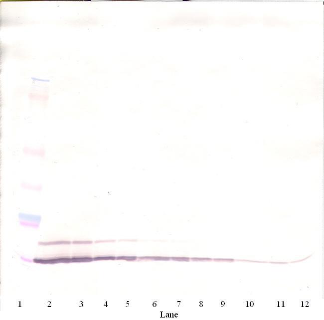 CCL5 (RANTES) Antibody in Western Blot (WB)