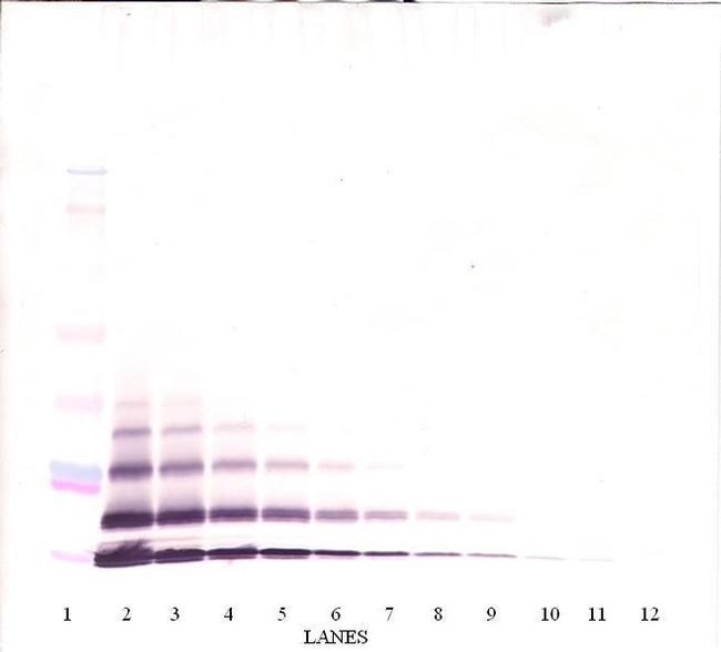 CXCL5 Antibody in Western Blot (WB)