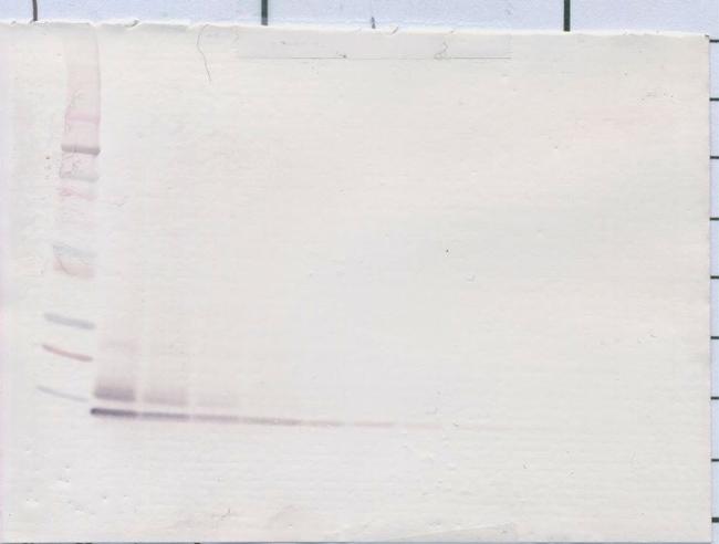 CXCL5 Antibody in Western Blot (WB)