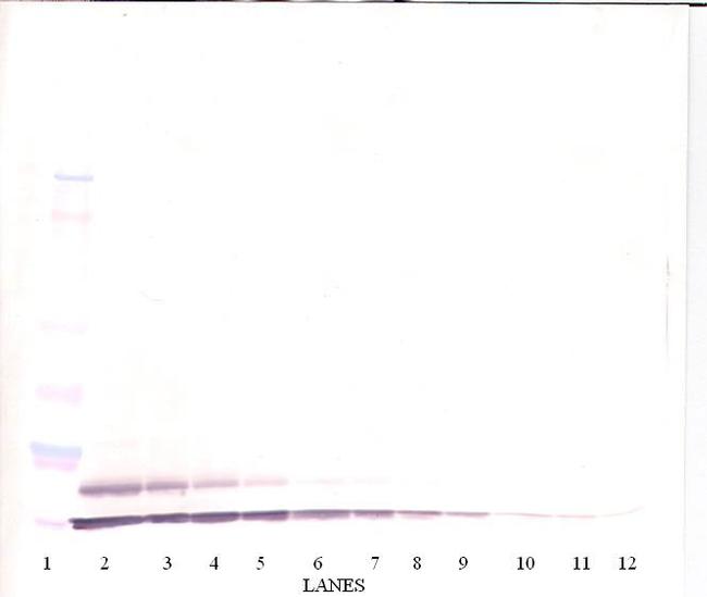 TARC Antibody in Western Blot (WB)