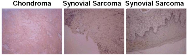 Osteocalcin Antibody in Immunohistochemistry (Paraffin) (IHC (P))