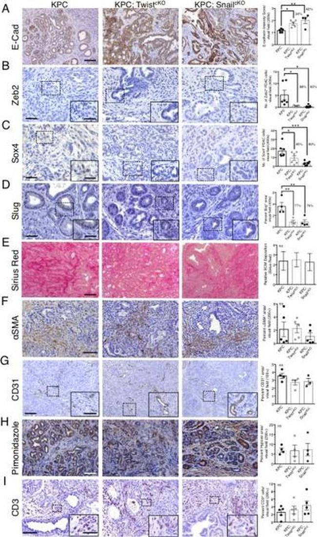 CD324 (E-Cadherin) Antibody in Immunohistochemistry (IHC)