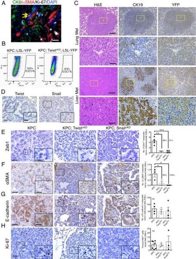 CD324 (E-Cadherin) Antibody in Immunohistochemistry (IHC)