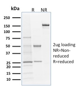 Langerin/CD207 (Marker of Langerhans Cells) Antibody in SDS-PAGE (SDS-PAGE)