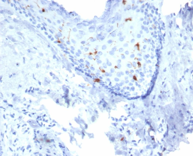Langerin/CD207 (Marker of Langerhans Cells) Antibody in Immunohistochemistry (Paraffin) (IHC (P))