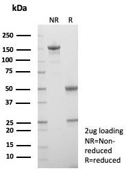 Langerin/CD207 (Marker of Langerhans Cells) Antibody in SDS-PAGE (SDS-PAGE)