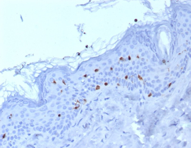 Langerin/CD207 (Marker of Langerhans Cells) Antibody in Immunohistochemistry (Paraffin) (IHC (P))