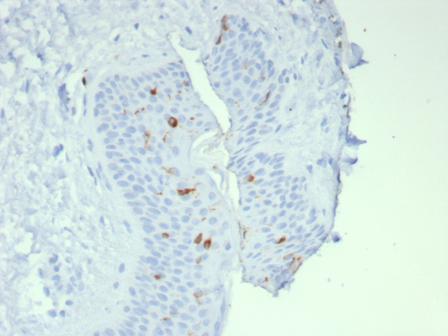 Langerin/CD207 (Marker of Langerhans Cells) Antibody in Immunohistochemistry (Paraffin) (IHC (P))