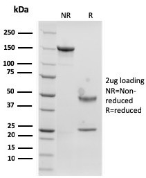 Langerin/CD207 (Marker of Langerhans Cells) Antibody in SDS-PAGE (SDS-PAGE)