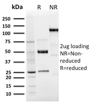 Langerin/CD207 (Marker of Langerhans Cells) Antibody in SDS-PAGE (SDS-PAGE)