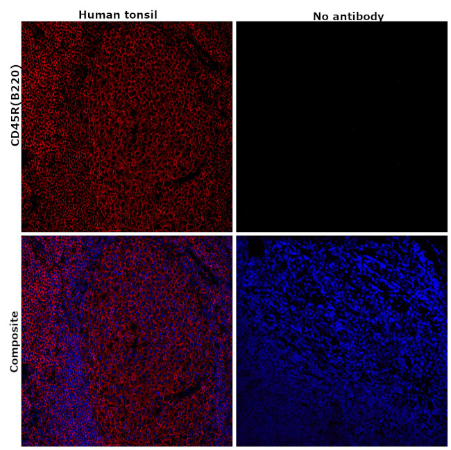 CD45R (B220) Antibody in Immunohistochemistry (Paraffin) (IHC (P))