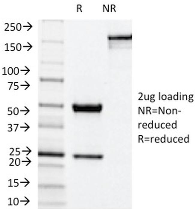 NOX4/NADPH Oxidase 4 Antibody in SDS-PAGE (SDS-PAGE)