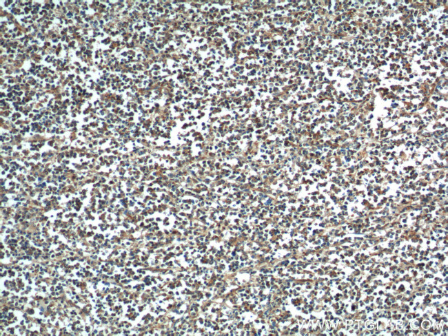 BAX Antibody in Immunohistochemistry (Paraffin) (IHC (P))