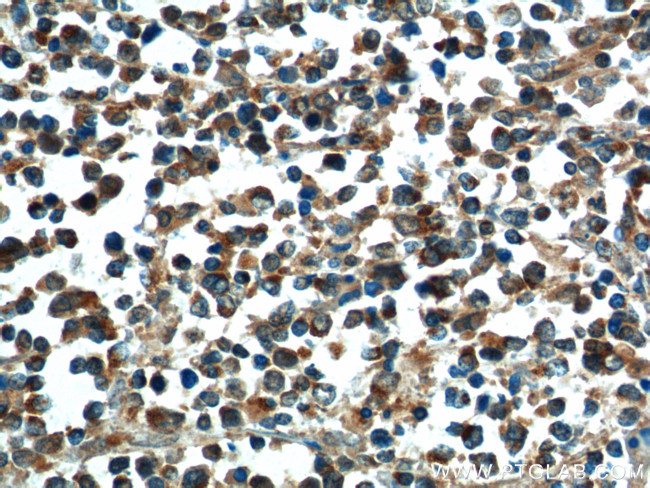 BAX Antibody in Immunohistochemistry (Paraffin) (IHC (P))