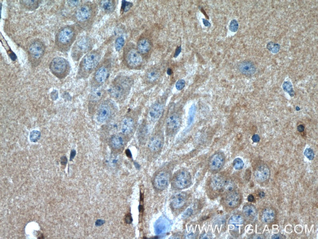 BAX Antibody in Immunohistochemistry (Paraffin) (IHC (P))