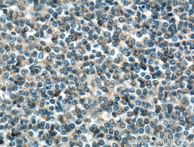 BAX Antibody in Immunohistochemistry (Paraffin) (IHC (P))