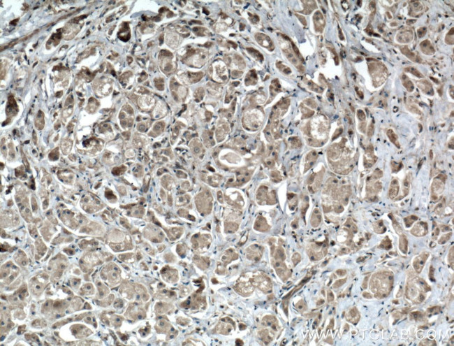 BAX Antibody in Immunohistochemistry (Paraffin) (IHC (P))