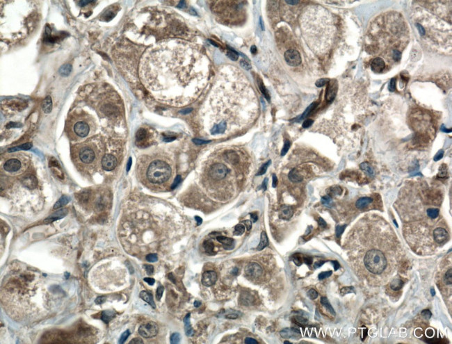 BAX Antibody in Immunohistochemistry (Paraffin) (IHC (P))