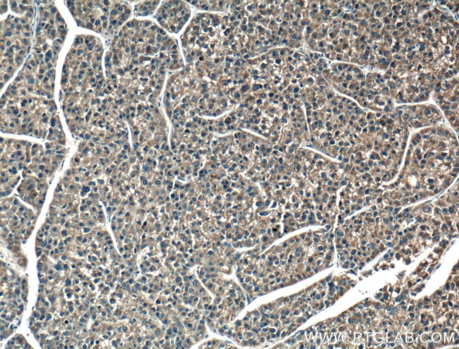 BAX Antibody in Immunohistochemistry (Paraffin) (IHC (P))