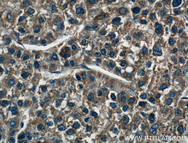 BAX Antibody in Immunohistochemistry (Paraffin) (IHC (P))