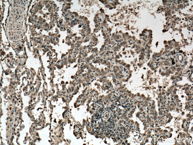 BAX Antibody in Immunohistochemistry (Paraffin) (IHC (P))